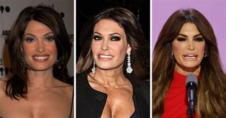 Kimberly Guilfoyle's Plastic Surgery: Unlocking Secrets And Revelations
